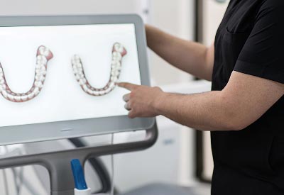 using 3D technology to help a patient's smile