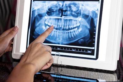 3D digital X-rays used at Universal Dentistry in Abington, PA