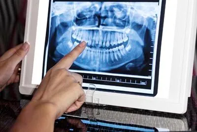 3D digital X-rays used at Universal Dentistry in Abington, PA
