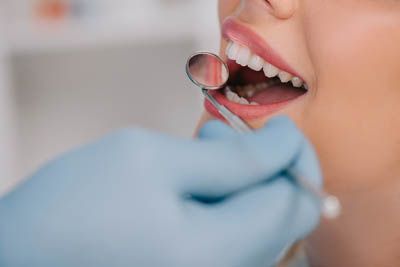 closeup of a patient receiving periodontal care at Universal Dentistry in Cherry Hill, NJ