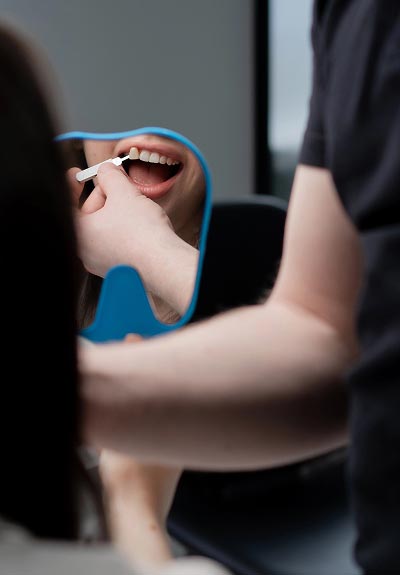 dental veneers Springfield, PA