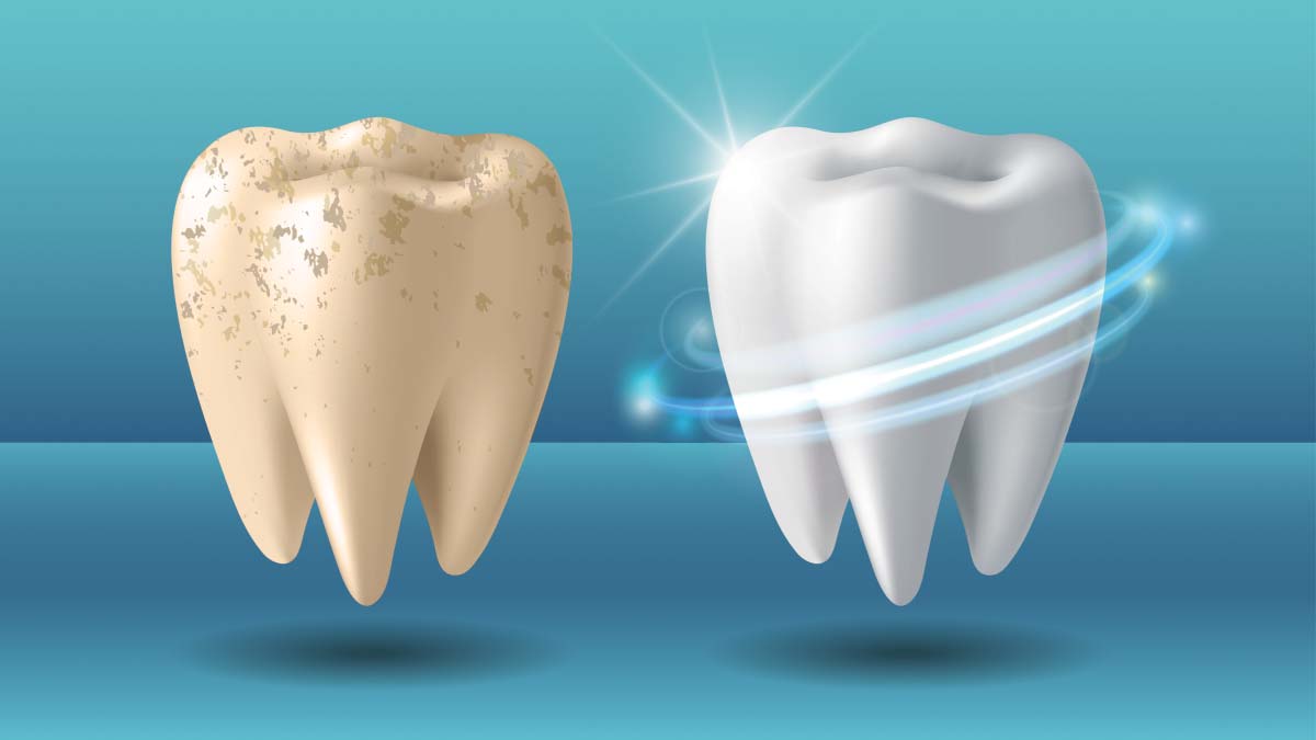 small diameter implants abington pa