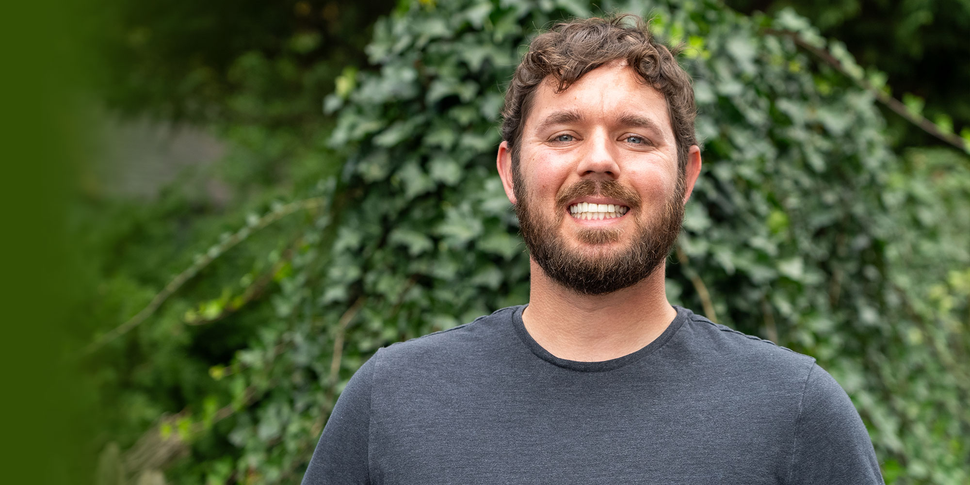 after getting zygomatic dental implants patient is able to confidently smile again